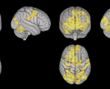 Исследование: какая медитация лучше всего влияет на мозг? 6 Исследование: какая медитация лучше всего влияет на мозг?